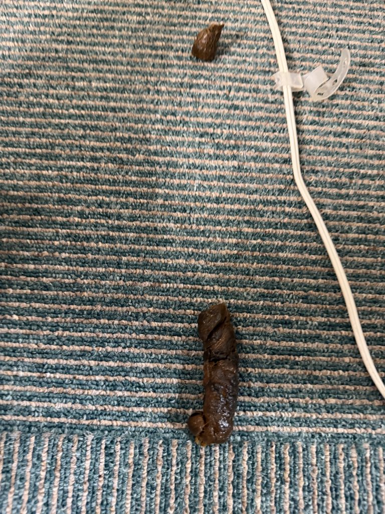 いきなり便の写真ですみません